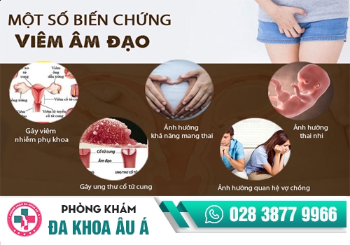 viêm âm đạo